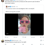 Burn of the Day